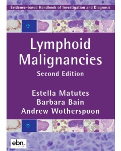 Lymphoid Malignancies Evidence-Based Handbook of Investigation and Diagnosis