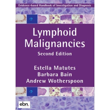 Lymphoid Malignancies Evidence-Based Handbook of Investigation and Diagnosis